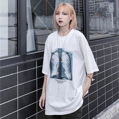 Internal Butterflies T-Shirt